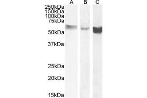 Image no. 6 for anti-Monoamine Oxidase B (MAOB) (Internal Region) antibody (ABIN185506)