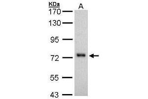 Image no. 2 for anti-5'-Nucleotidase, Ecto (CD73) (NT5E) (Center) antibody (ABIN2854948)