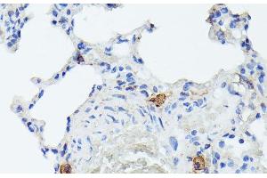 Immunohistochemistry of paraffin-embedded Rat lung using TIAL1 Polyclonal Antibody at dilution of 1:100 (40x lens).