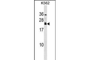 HAND2 Antibody (Center) (ABIN1538642 and ABIN2848660) western blot analysis in K562 cell line lysates (35 μg/lane).
