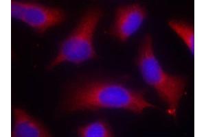 Image no. 3 for anti-Microtubule-Associated Protein tau (MAPT) (pSer262) antibody (ABIN3020340)