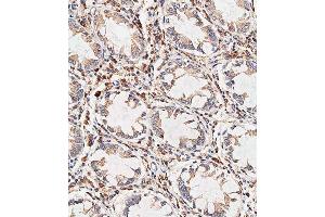 Immunohistochemical analysis of paraffin-embedded human colon tissue using C performed on the Leica® BOND RXm.