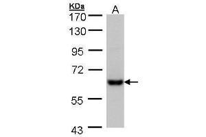 Image no. 2 for anti-Carboxylesterase 2 (CES2) (Center) antibody (ABIN2855810)