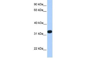 ACRV1 antibody  (N-Term)