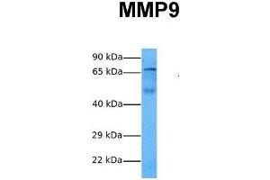 Image no. 5 for anti-Matrix Metallopeptidase 9 (Gelatinase B, 92kDa Gelatinase, 92kDa Type IV Collagenase) (MMP9) (N-Term) antibody (ABIN2777743)
