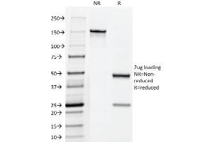 Fascin antibody