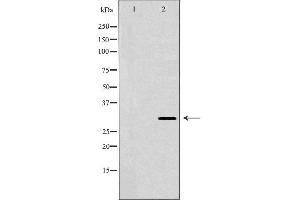 anti-Major Histocompatibility Complex, Class II, DR beta 3 (HLA-DRB3) antibody