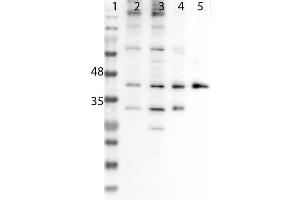 Image no. 1 for anti-Sine Oculis-Related Homeobox 3 (SIX3) (Internal Region) antibody (ABIN6657912)