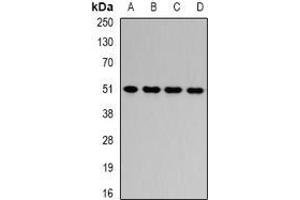 Image no. 2 for anti-Hydroxyacyl-CoA Dehydrogenase/3-Ketoacyl-CoA Thiolase/enoyl-CoA Hydratase (Trifunctional Protein), beta Subunit (HADHB) (full length) antibody (ABIN6005222)
