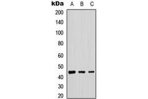 Image no. 2 for anti-UDP-Gal:betaGlcNAc beta 1,4- Galactosyltransferase, Polypeptide 2 (B4GALT2) (C-Term) antibody (ABIN2704514)