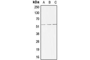 Image no. 3 for anti-Activin A Receptor Type II-Like 1 (ACVRL1) (Center) antibody (ABIN2705437)