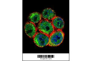 Image no. 4 for anti-Slingshot Homolog 3 (SSH3) (AA 575-602), (C-Term) antibody (ABIN655643)