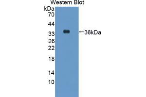 Image no. 2 for anti-Glutamine-Fructose-6-Phosphate Transaminase 2 (GFPT2) (AA 2-288) antibody (ABIN1868138)