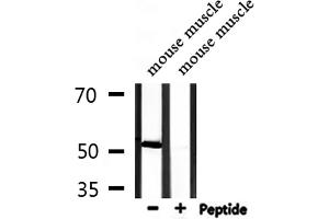 Image no. 4 for anti-Inositol Hexakisphosphate Kinase 3 (IP6K3) (Internal Region) antibody (ABIN6258488)