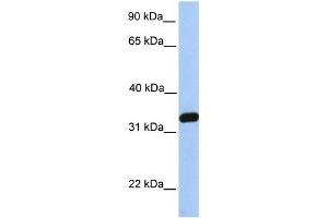 Image no. 1 for anti-NFKB Inhibitor Interacting Ras-Like 2 (NKIRAS2) (C-Term) antibody (ABIN2785678)