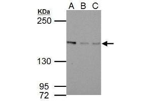 WB Image Sample (30 ug of whole cell lysate)          A: NIH-3T3         B: JC         C: BCL-1         5% SDS PAGE          antibody diluted at 1:1000         