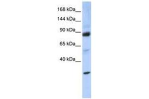 Image no. 1 for anti-Zinc Fingers and Homeoboxes 3 (ZHX3) (AA 864-913) antibody (ABIN6744228)