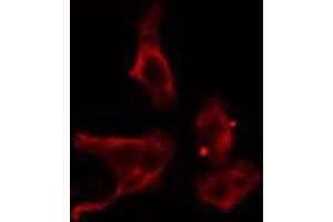 Image no. 2 for anti-Adenylate Cyclase 4 (ADCY4) (Internal Region) antibody (ABIN6256933)