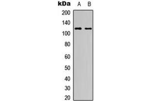 Image no. 3 for anti-Notch 1 (NOTCH1) (Center) antibody (ABIN2706704)