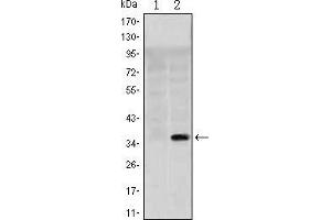 Image no. 2 for anti-Solute Carrier Family 22 (Organic Cation Transporter), Member 1 (SLC22A1) antibody (ABIN969400)