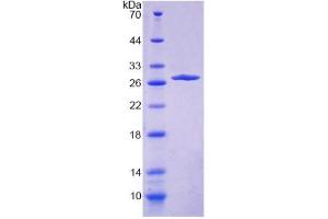 Image no. 1 for Collagen, Type IV, alpha 4 (Col4A4) (AA 1469-1690) protein (His tag) (ABIN6239048)