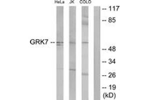 Image no. 1 for anti-G Protein-Coupled Receptor Kinase 7 (GRK7) (AA 371-420) antibody (ABIN1534027)