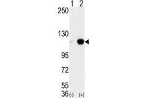 Western blot analysis of LSD1 antibody and 293 cell lysate either nontransfected (Lane 1) or transiently transfected with the AOF2 gene (2).
