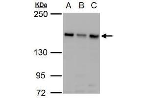 Image no. 1 for anti-rho-Associated, Coiled-Coil Containing Protein Kinase 2 (ROCK2) (Center) antibody (ABIN2855440)