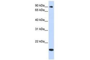 Image no. 1 for anti-TSR1, 20S rRNA Accumulation, Homolog (TSR1) (AA 648-697) antibody (ABIN6740961)