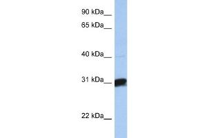 Image no. 1 for anti-UDP-Gal:betaGal beta 1,3-Galactosyltransferase Polypeptide 6 (B3GALT6) (C-Term) antibody (ABIN2784120)