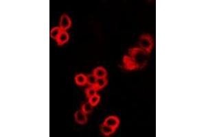 Image no. 2 for anti-Mucosa Associated Lymphoid Tissue Lymphoma Translocation Gene 1 (MALT1) (full length) antibody (ABIN6043652)