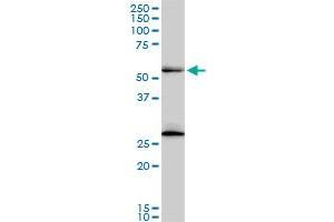 Image no. 4 for anti-Pre-mRNA Processing Factor 19 (PRPF19) (AA 1-90) antibody (ABIN525975)