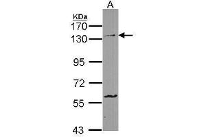 Image no. 1 for anti-Protocadherin 1 (PCDH1) (C-Term) antibody (ABIN2856966)