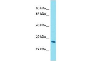 Image no. 1 for anti-Glutathione S-Transferase theta 2 (GSTT2) (Middle Region) antibody (ABIN2789659)