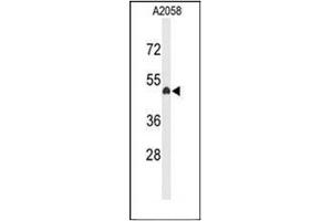 Image no. 3 for anti-Eyes Absent Homolog 4 (EYA4) (C-Term) antibody (ABIN952150)
