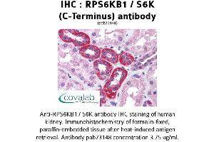 Image no. 1 for anti-Ribosomal Protein S6 Kinase, 70kDa, Polypeptide 1 (RPS6KB1) (C-Term) antibody (ABIN1738954)
