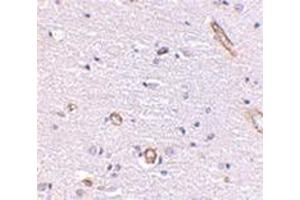 Image no. 1 for anti-Syntaphilin (SNPH) (Center) antibody (ABIN500853)