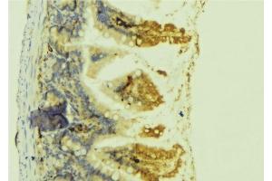 Image no. 2 for anti-Cardiotrophin 1 (CTF1) (Internal Region) antibody (ABIN6260463)