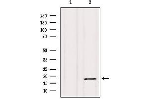 Image no. 4 for anti-Calmodulin 1 (Calm1) antibody (ABIN6260417)