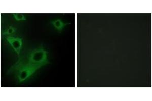 Image no. 2 for anti-Cell Death-Inducing DFFA-Like Effector C (CIDEC) (AA 189-238) antibody (ABIN1534332)