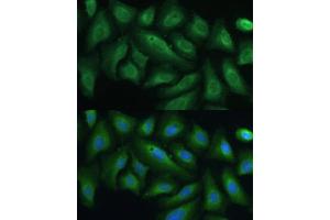 Immunofluorescence analysis of U-2 OS cells using PTPN22 antibody (ABIN3021952, ABIN3021953, ABIN1513449 and ABIN6218285) at dilution of 1:100.
