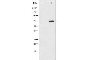 Image no. 3 for anti-V-Raf-1 Murine Leukemia Viral Oncogene Homolog 1 (RAF1) (pSer338) antibody (ABIN6255230)