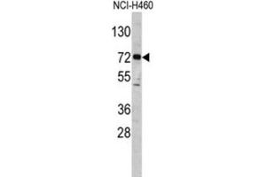 Image no. 3 for anti-Elongator Acetyltransferase Complex Subunit 2 (ELP2) antibody (ABIN3001690)