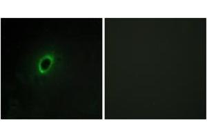 Image no. 2 for anti-Brain-Enriched Guanylate Kinase-Associated (BEGAIN) (AA 511-560) antibody (ABIN1534096)