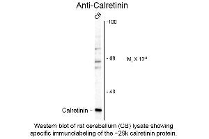 Image no. 2 for anti-Calbindin 2 (CALB2) antibody (ABIN6655054)
