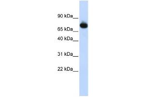 Image no. 1 for anti-Zinc Finger Protein 278 (ZNF278) antibody (ABIN2458359)
