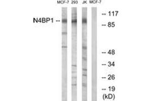 Image no. 1 for anti-NEDD4 Binding Protein 1 (N4BP1) (AA 383-432) antibody (ABIN1535080)