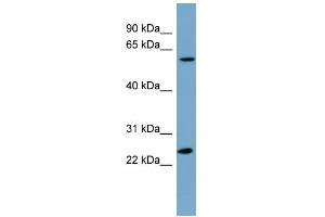 anti-Leucine Rich Repeat Containing 6 (LRRC6) (N-Term) antibody