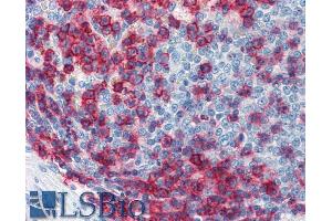 Image no. 3 for anti-Sialophorin (SPN) antibody (FITC) (ABIN94119)