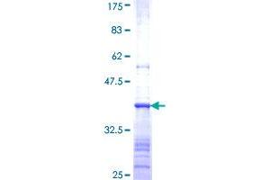 Image no. 1 for Bile Acid CoA: Amino Acid N-Acyltransferase (Glycine N-Choloyltransferase) (BAAT) (AA 258-355) protein (GST tag) (ABIN1346343)